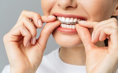 Invisalign Orthodontic Treatment – Clear Braces