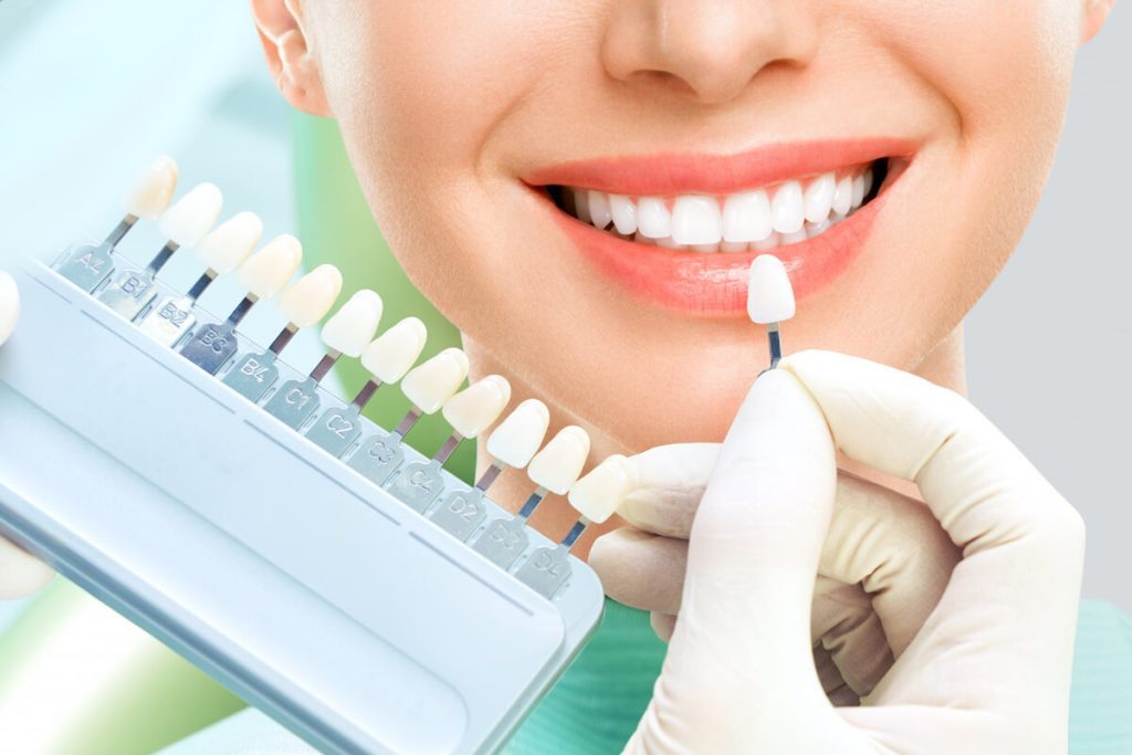 transform your smile with dental porcelain veneers