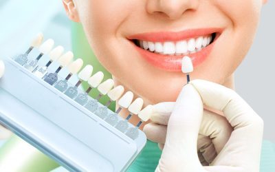 Transform Your Smile with Dental Porcelain Veneers: Your Path to a Perfect Smile